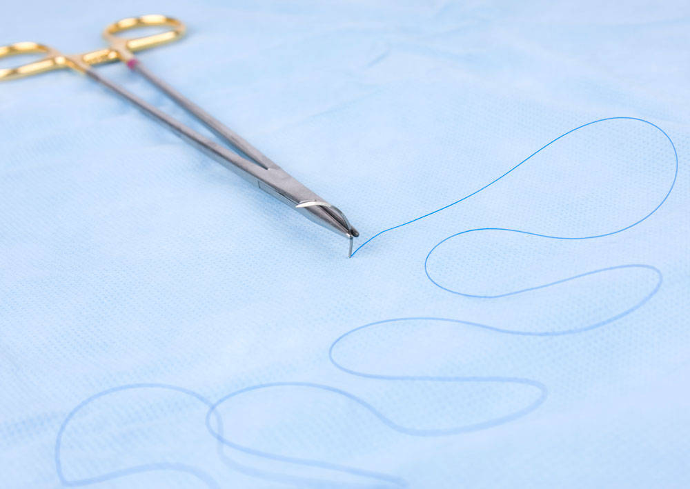 Surgical Sutures